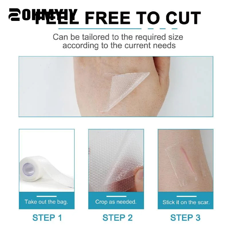 1.5M/1Roll White Silicone Scar Removal Tape For Surgical Scars Medical Grade Scar Sheet Painless Scar Repair Tape Effective