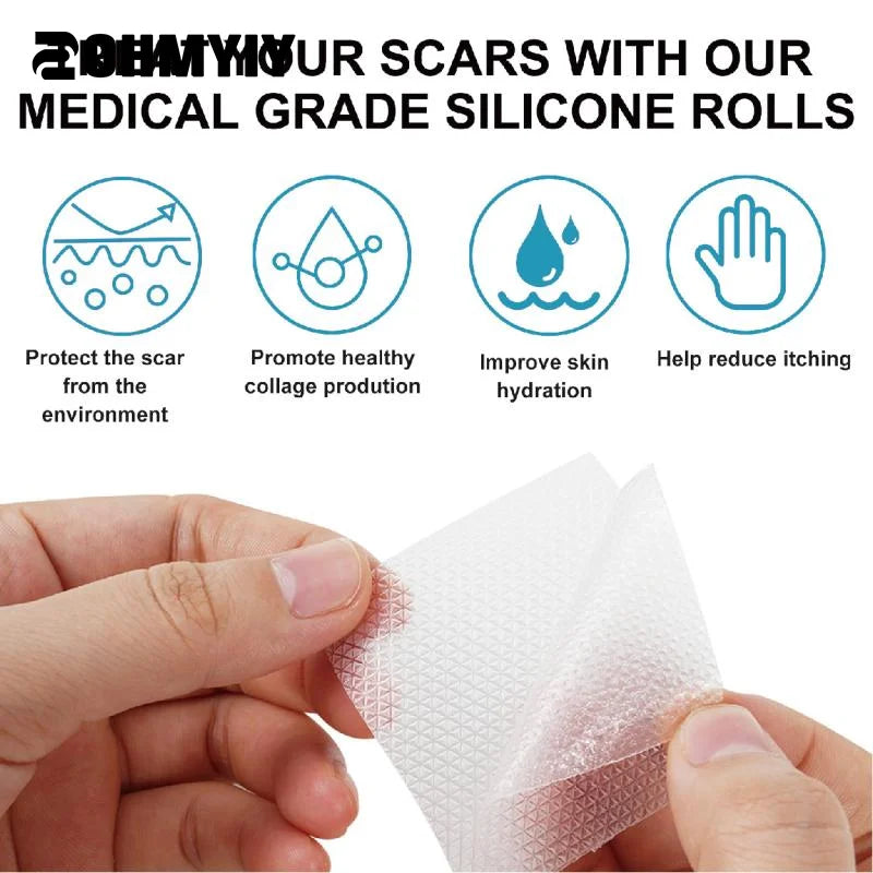 1.5M/1Roll White Silicone Scar Removal Tape For Surgical Scars Medical Grade Scar Sheet Painless Scar Repair Tape Effective