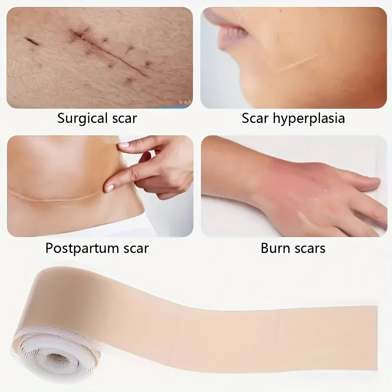 Silicone Scar Tape Roll ， Silicone Gel Tape And Concealing Scars, Scar Cover Up Adhesive Tape for Surgical