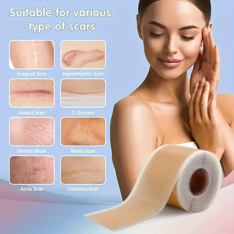 Silicone Scar Tape Roll ， Silicone Gel Tape And Concealing Scars, Scar Cover Up Adhesive Tape for Surgical